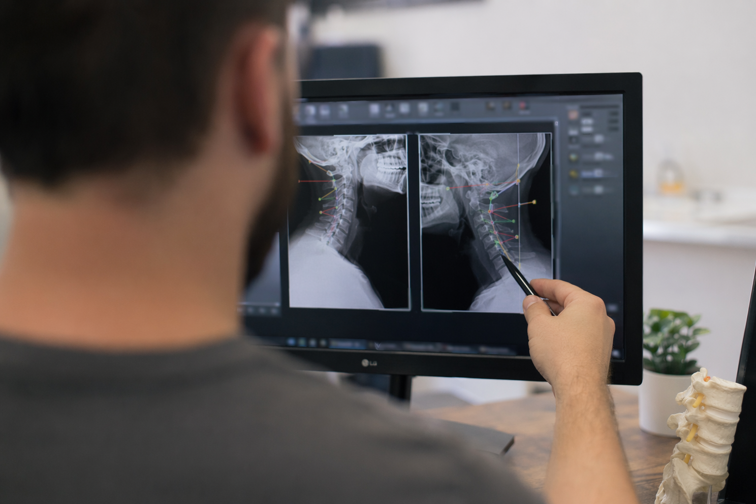 How Chiropractic Biophysics applies to Chiropractor services in Nashville, United States—practical illustration